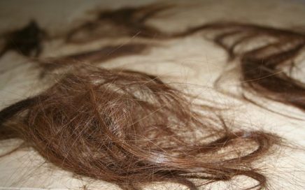 Image of strands of hair that have fallen out